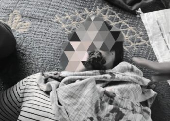 Masyarakat Adat Sihaporas Diserang: 33 Orang Luka, Rumah dan Posko Dibakar Seorang petani adat yang menjadi korban pemukulan saa penyerangan di Lamtoras Sihaporas, Kabupaten Simalungun, Senin (22/09/2025). (Foto: Aman Tano Batak)