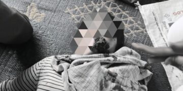 Seorang petani adat yang menjadi korban pemukulan saa penyerangan di Lamtoras Sihaporas, Kabupaten Simalungun, Senin (22/09/2025). (Foto: Aman Tano Batak)