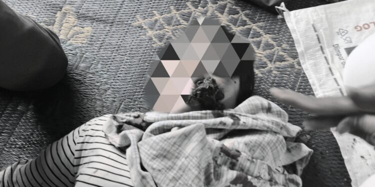 Masyarakat Adat Sihaporas Diserang: 33 Orang Luka, Rumah dan Posko Dibakar Seorang petani adat yang menjadi korban pemukulan saa penyerangan di Lamtoras Sihaporas, Kabupaten Simalungun, Senin (22/09/2025). (Foto: Aman Tano Batak)